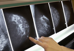 ��������� ������ ��� 4-� ����������� ��������� ����� ��������������� ������������