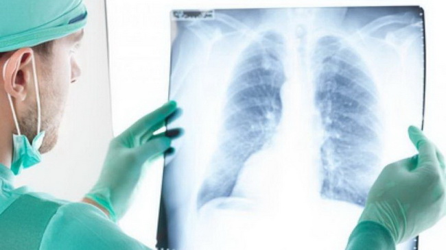 � ��������� ����������� �������� ����� ������� �� ���� ������