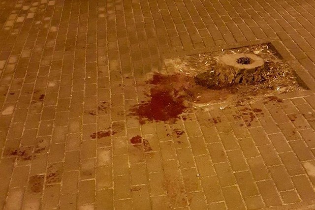 В центре Днепра возле кафе мужчину ударили ножом: пострадавший умер на операционном столе