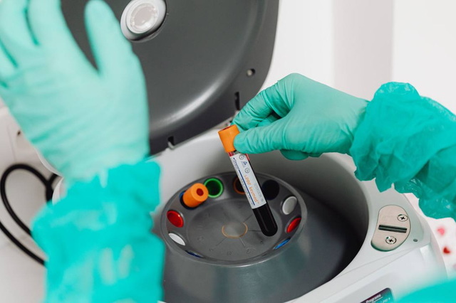 Епідемічна ситуація: рівень захворюваності на ГРВІ зменшився