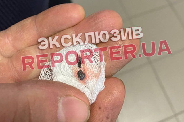 � ������ �������� ��������� ����������� ������� � �����