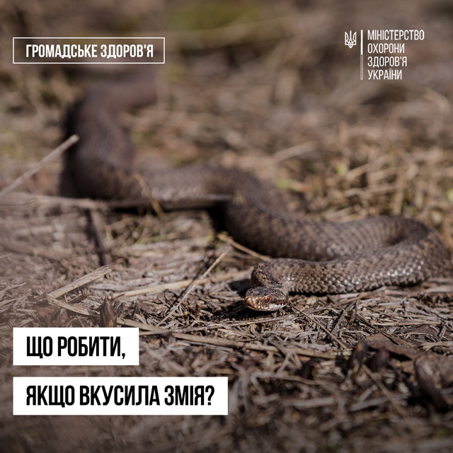 �� ���������������� ������� ����� ���������� ����: ��� ����������� ����?