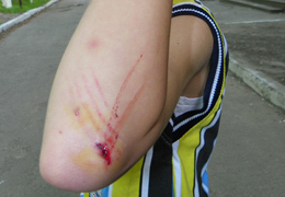 ��������� ��� ������� �������