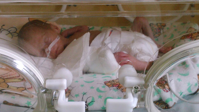 Мужичок с ноготок: помогите Саше выжить!