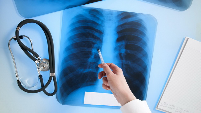 � ������� ���� � ���'�������� ������� 72 ������ �� �����������