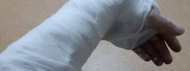 В Днепре избили мужчину за улыбку и хорошее настроение