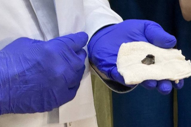 Уламок, який дістали з тіла одного з поранених внаслідок удару РФ. Суспільне Дніпро В больницу на Днепропетровщине доставили 5 раненых из-за удара рф по Яровой в Донецкой области