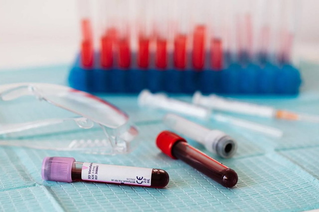 Эпидемиологическая ситуация на Днепропетровщине: COVID отступает, 5 человек отравились грибами, выявлен очаг бешенства