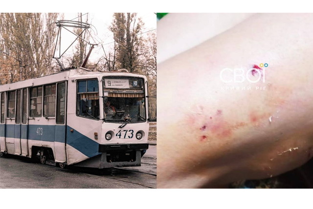 У Кривому Розі пасажир нацькував собаку на водійку трамвая: жінка в лікарні