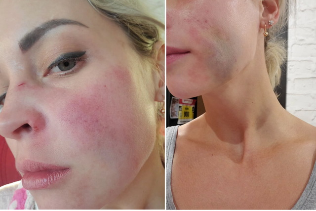 Мешканку Дніпра збив водій, який мав сумарно понад 17 років заборони на керування