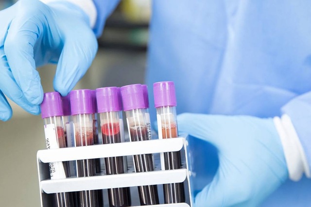 Эпидемиологическая ситуация на Днепропетровщине