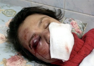 ���: �������� ��� �������� �������� ��������� �� ����������������